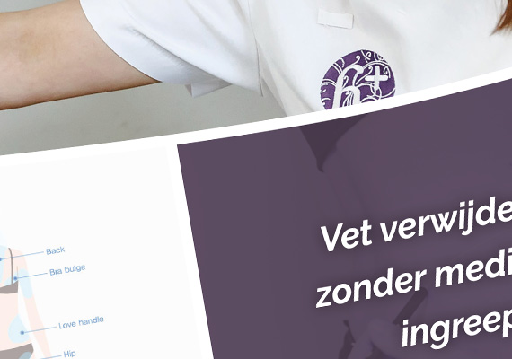 Diverse canvasdoeken met een dikte van 40mm welke geplaatst zijn in de wachtkamer/lobby